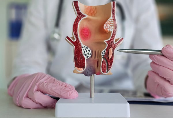 פרוקטולוגיה