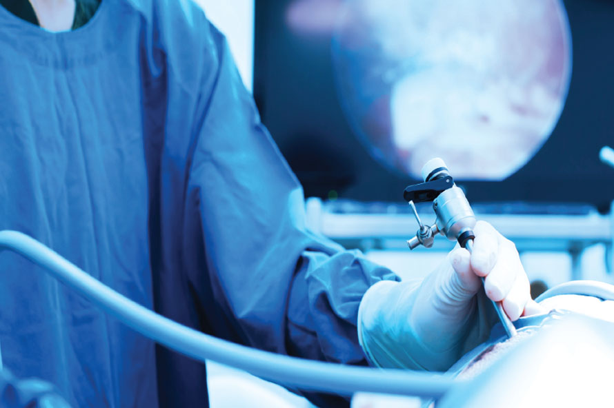 ניתוח כריתת טחול לפרוסקופית