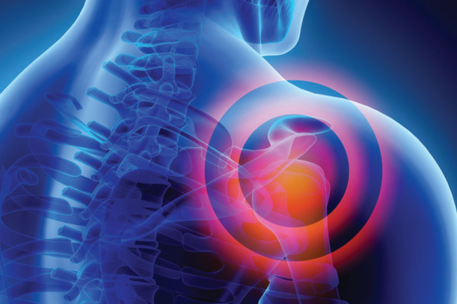 ניתוח החלפת כתף