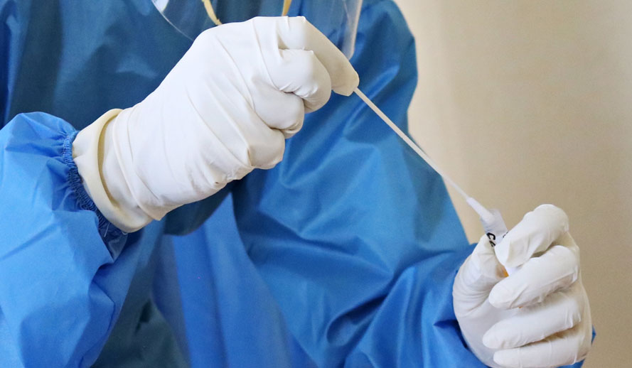 קורונה - COVID 19