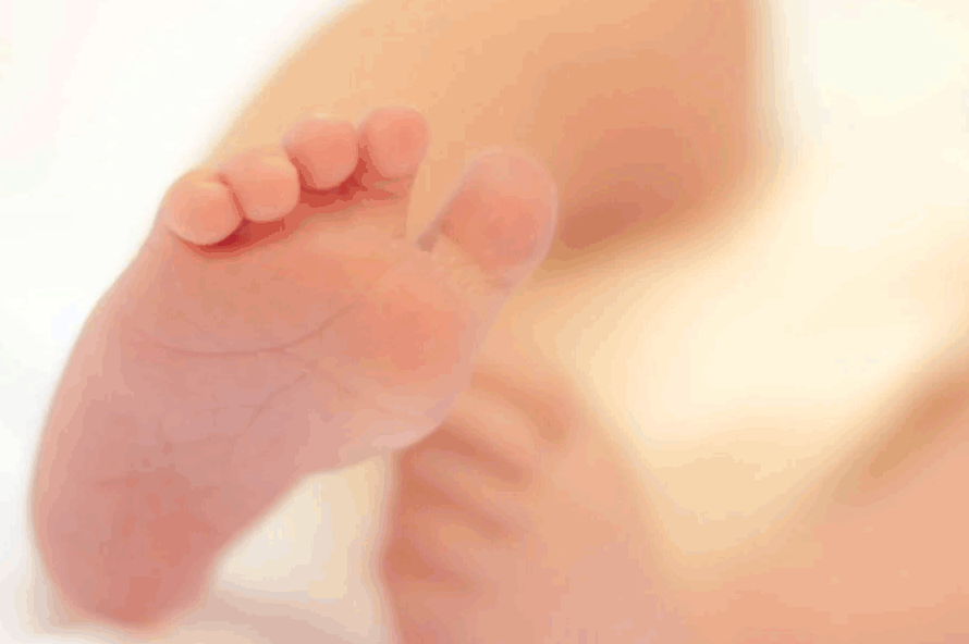 ניתוח קיסרי ידידותי - ניתוח קיסרי אלקטיבי - חדרי לידה מעיני הישועה